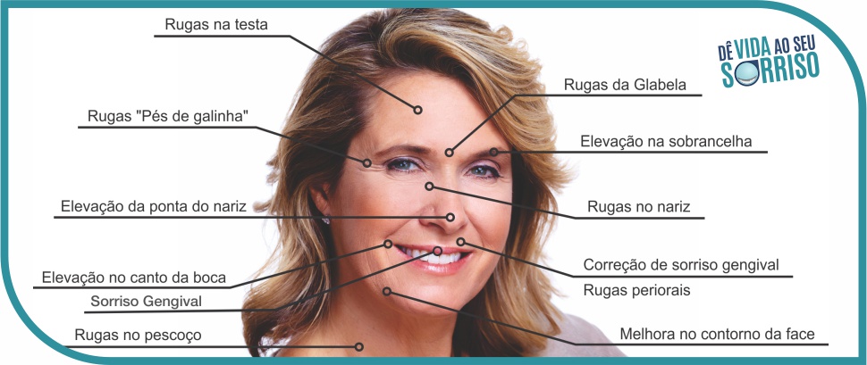 botox